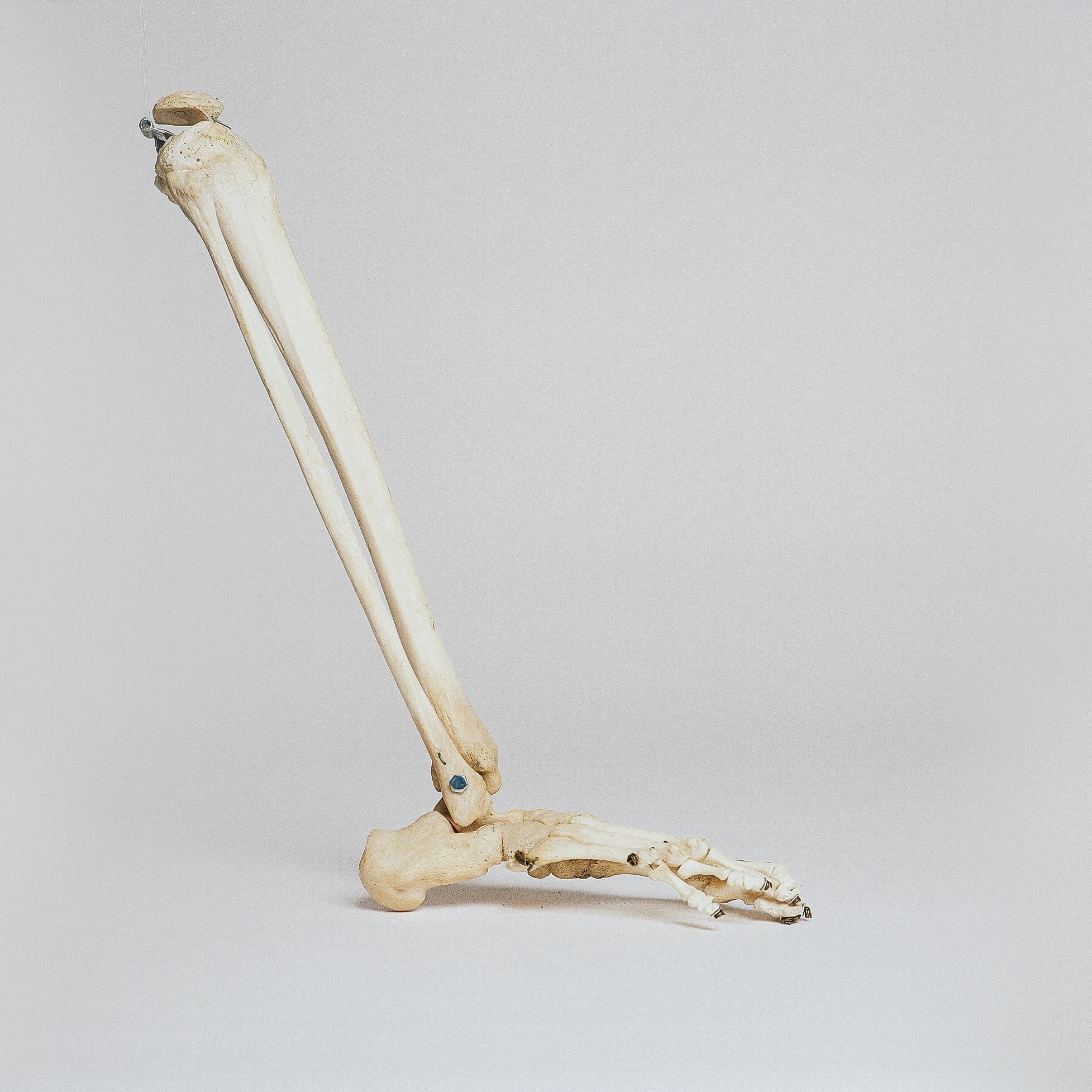 Osteologický kvíz – Dolní končetina